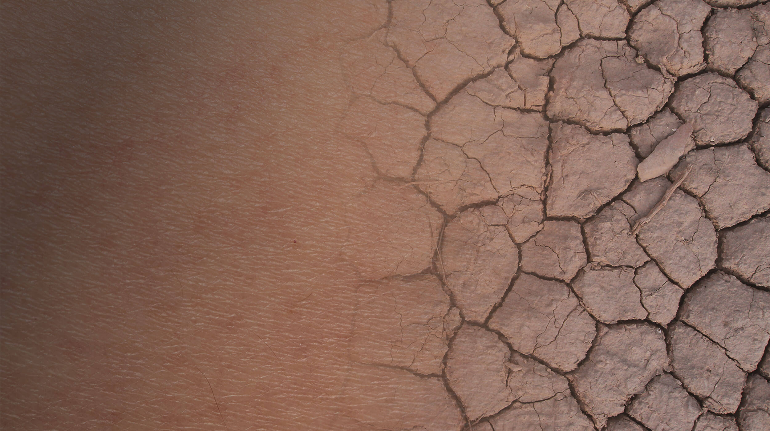 Εικόνα ξηρού χώματος με ρωγμές, που μοιάζει με την εικόνα του αφυδατωμένου δέρματος. 