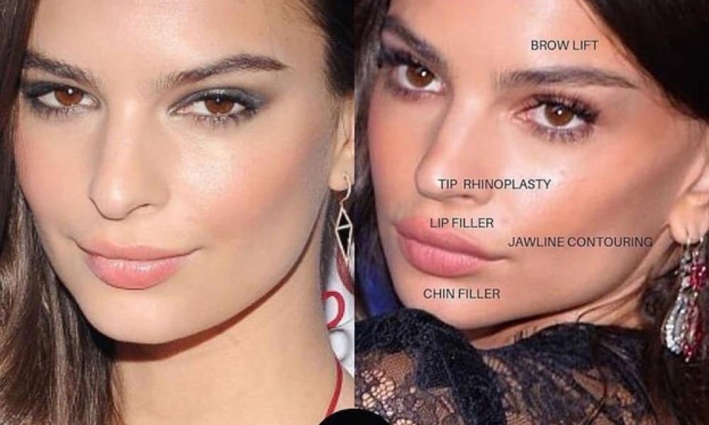 ABH Beautification before after