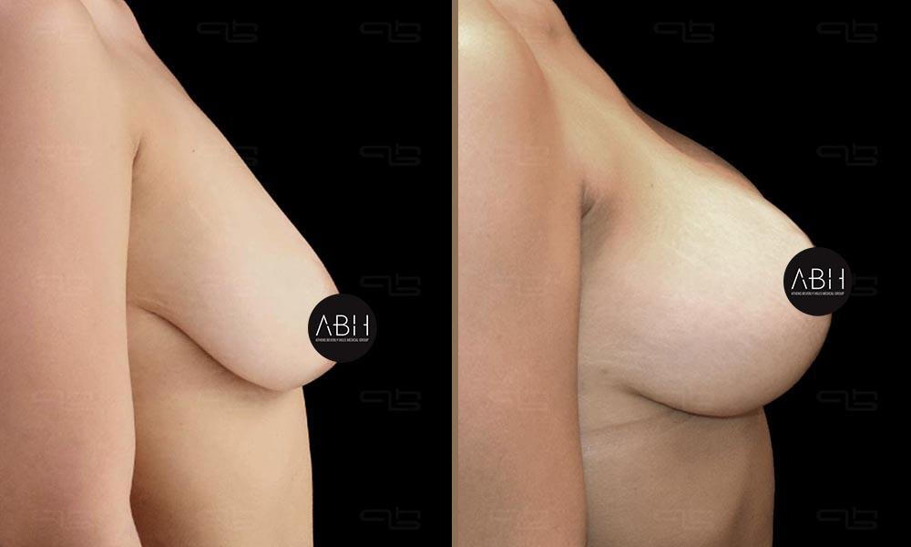 gkioylmpalogloy-maria 3