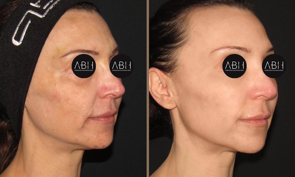 DLIFT anagnostopoulou B