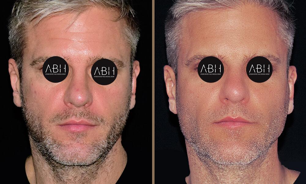 Beau_D_Fill florence-chris A