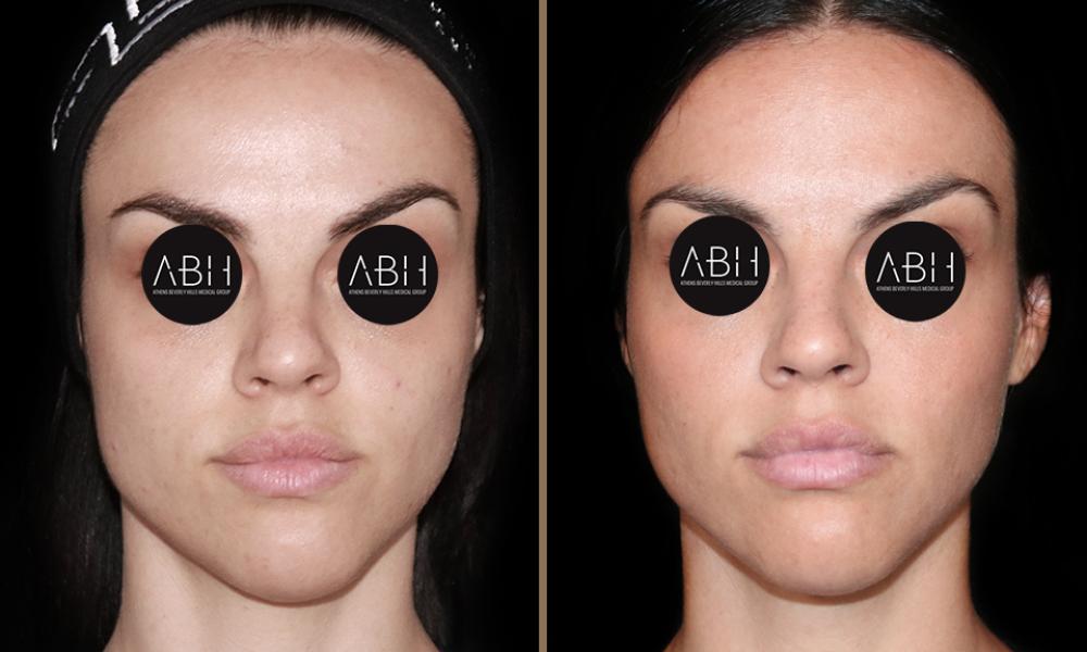 Beau_D_Fill gerontati A