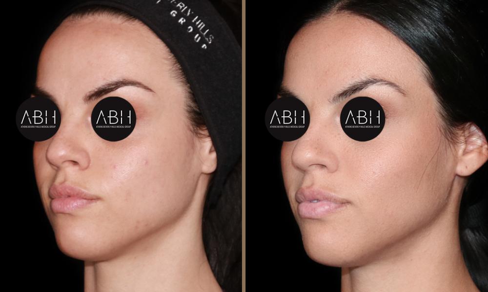 Beau_D_Fill  gerontati B