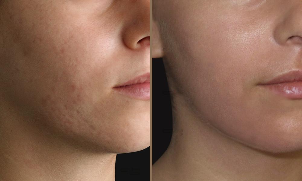 magellan_beltiosi-01