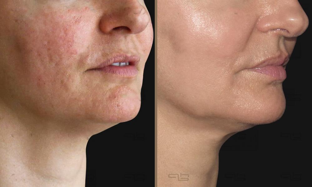 magellan_beltiosi-02