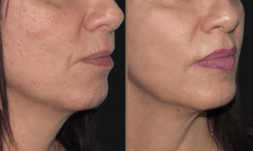 magellan_beltiosi-yfis