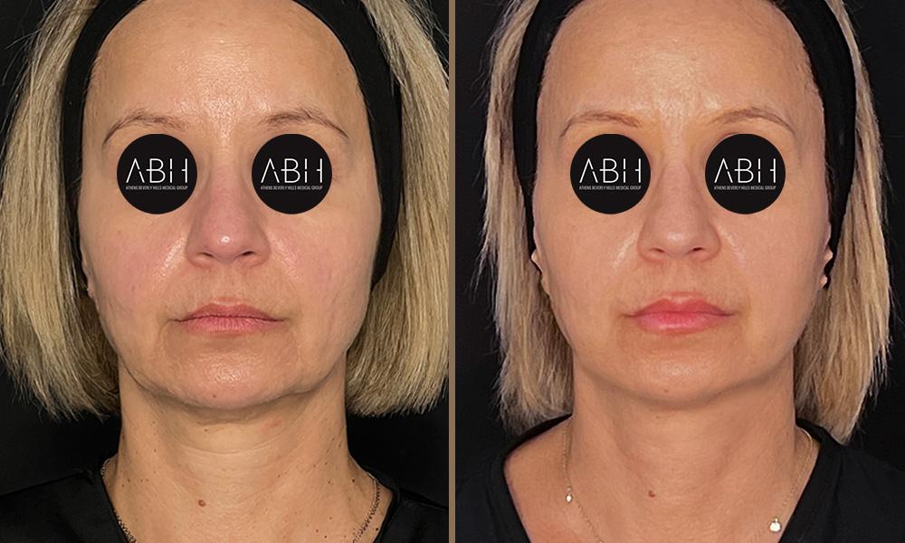 morfeus-kiriakopoulou