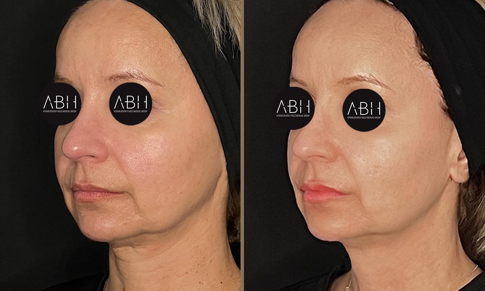 morfeus-kiriakopoulou B