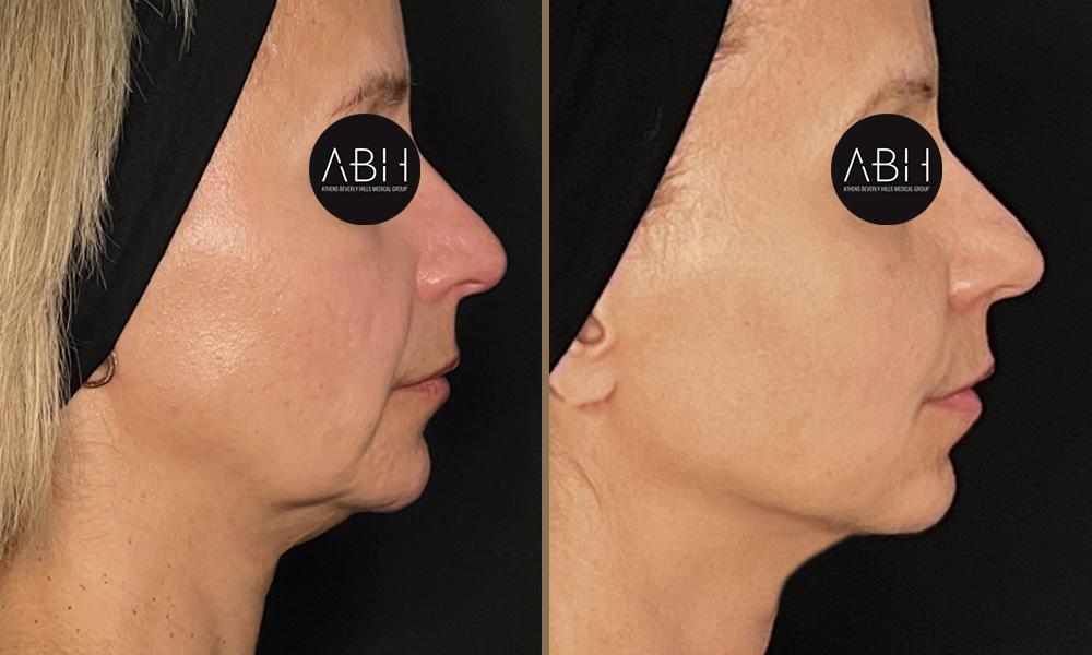 morfeus-kiriakopoulou C