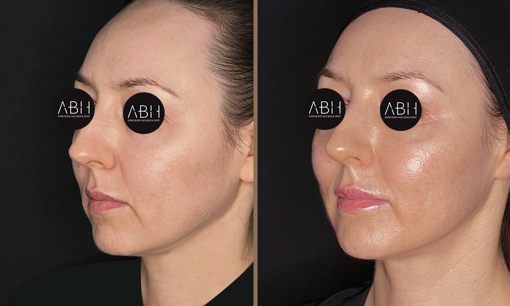 Beau_D_Fill papadopoulou B