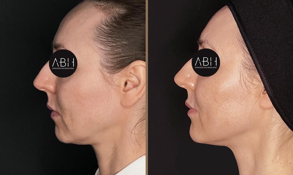 Beau_D_Fill papadopoulou C