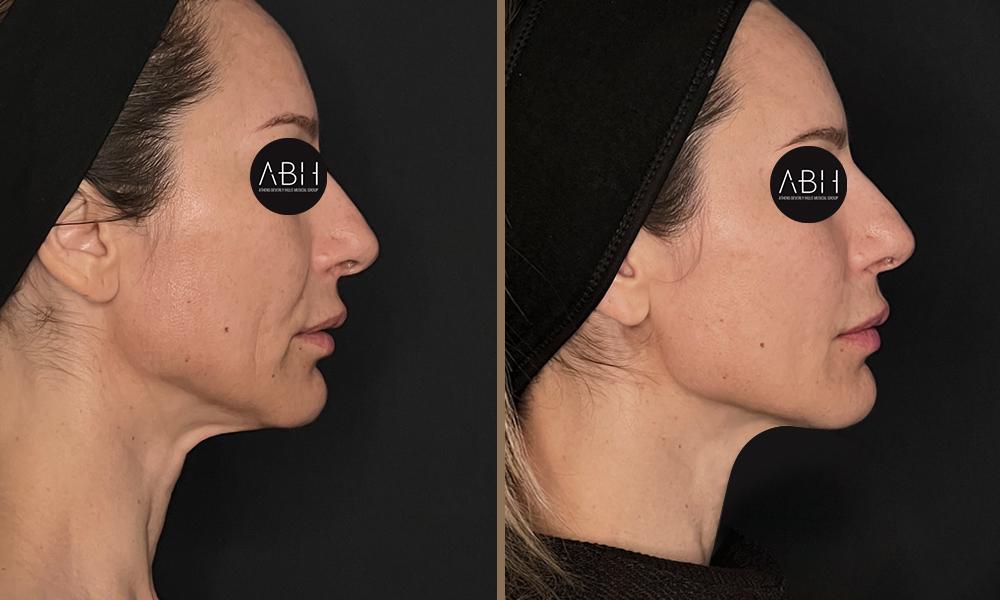 Beau_D_Fill stanescu C